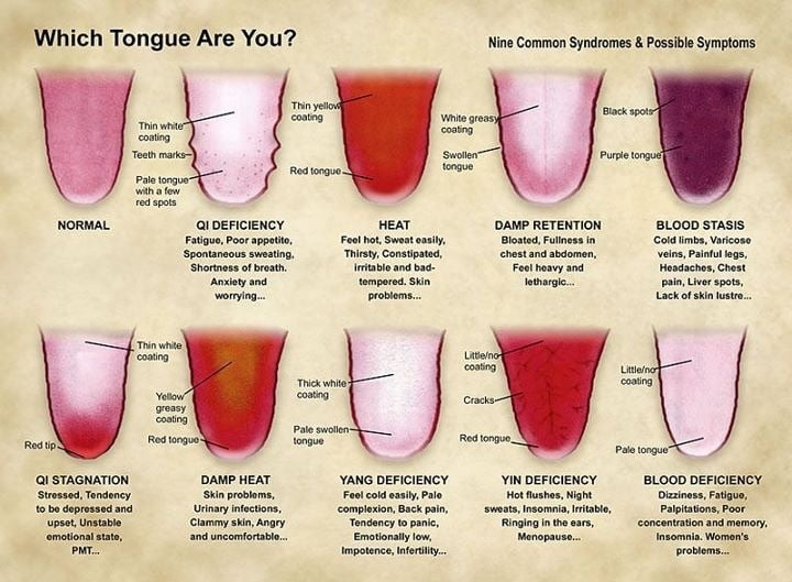 Tongue types